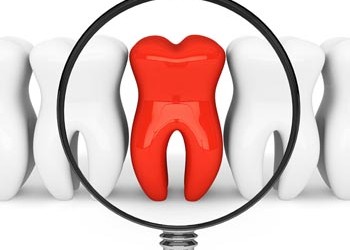 Dental Emergency